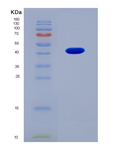 SDS-PAGE analysis of Human EZH2 (Histone-Lysine N-Methyltransferase Ezh2) - Recombinant Protein, CAT# BLT-08773P showing >90% purity under 15% SDS-PAGE (Reduced)