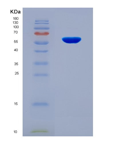 SDS-PAGE analysis of Human HDAC1 (Histone Deacetylase 1) - Recombinant Protein, CAT# BLT-08774P showing >90% purity under 15% SDS-PAGE (Reduced)