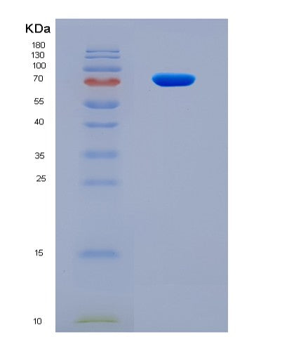 SDS-PAGE analysis of Human HDAC2 (Histone Deacetylase 2) - Recombinant Protein, CAT# BLT-08775P showing >90% purity under 15% SDS-PAGE (Reduced)