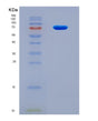 SDS-PAGE analysis of Human HDAC2 (Histone Deacetylase 2) - Recombinant Protein, CAT# BLT-08775P showing >90% purity under 15% SDS-PAGE (Reduced)