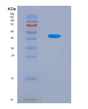 SDS-PAGE analysis of Human Histone deacetylase 8 (HDAC8) - Recombinant Protein, CAT# BLT-08777P showing >90% purity under 15% SDS-PAGE (Reduced)