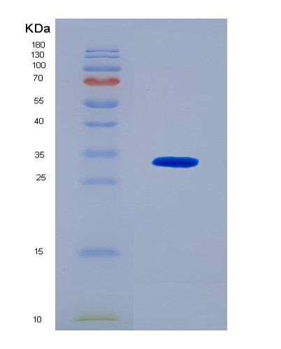 SDS-PAGE analysis of Human IL12A (Interleukin-12 Subunit Alpha) - Recombinant Protein, CAT# BLT-08779P showing >90% purity under 15% SDS-PAGE (Reduced)