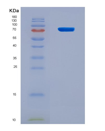 SDS-PAGE analysis of Human P4HA1 (Prolyl 4-Hydroxylase Subunit Alpha-1) - Recombinant Protein, CAT# BLT-08781P showing >90% purity under 15% SDS-PAGE (Reduced)