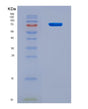 SDS-PAGE analysis of Human P4HA1 (Prolyl 4-Hydroxylase Subunit Alpha-1) - Recombinant Protein, CAT# BLT-08781P showing >90% purity under 15% SDS-PAGE (Reduced)