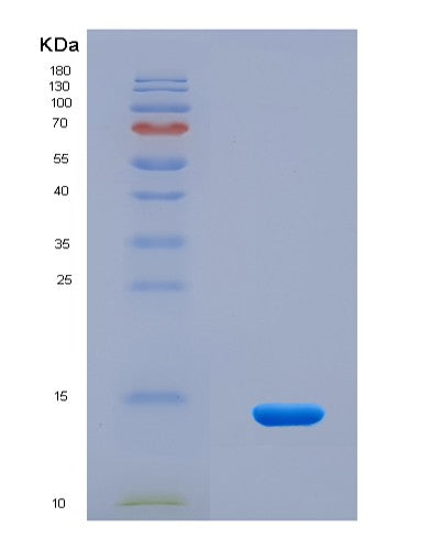 SDS-PAGE analysis of Mouse Nnat (Neuronatin) - Recombinant Protein, CAT# BLT-08782P showing >90% purity under 15% SDS-PAGE (Reduced)