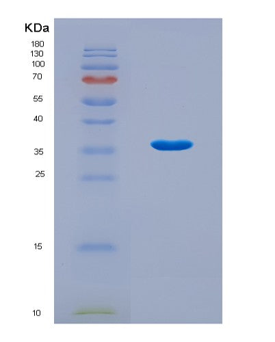 SDS-PAGE analysis of Mouse Hnrnpa1 (Heterogeneous Nuclear Ribonucleoprotein A1) - Recombinant Protein, CAT# BLT-08784P showing >90% purity under 15% SDS-PAGE (Reduced)