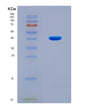 SDS-PAGE analysis of Human NPY (Pro-Neuropeptide Y) - Recombinant Protein, CAT# BLT-08787P showing >90% purity under 15% SDS-PAGE (Reduced)