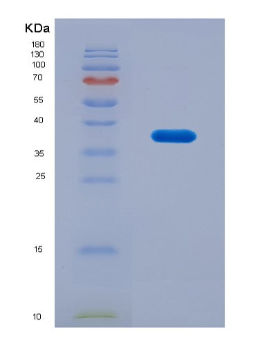 SDS-PAGE analysis of Human CEP55 (Centrosomal Protein Of 55 Kda) - Recombinant Protein, CAT# BLT-08788P showing >90% purity under 15% SDS-PAGE (Reduced)