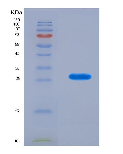 SDS-PAGE analysis of Human SFTPA1 (Pulmonary Surfactant-Associated Protein A1) - Recombinant Protein, CAT# BLT-08790P showing >90% purity under 15% SDS-PAGE (Reduced)