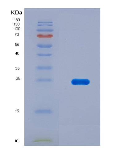 SDS-PAGE analysis of Human SFTPB (Pulmonary Surfactant-Associated Protein B) - Recombinant Protein, CAT# BLT-08791P showing >90% purity under 15% SDS-PAGE (Reduced)