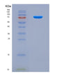 SDS-PAGE analysis of Human HGF (Hepatocyte Growth Factor) - Recombinant Protein, CAT# BLT-08792P showing >90% purity under 15% SDS-PAGE (Reduced)