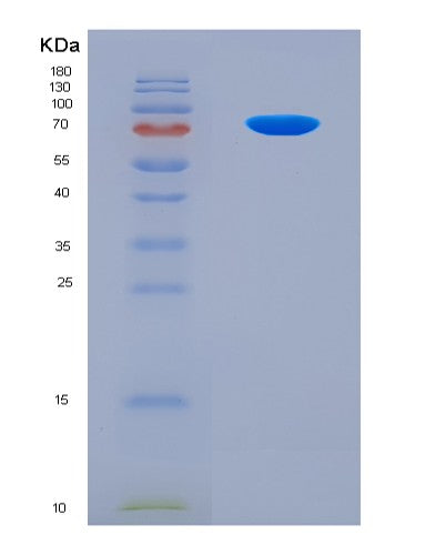 SDS-PAGE analysis of Human CTNNB1 (Catenin Beta-1) - Recombinant Protein, CAT# BLT-08794P showing >90% purity under 15% SDS-PAGE (Reduced)