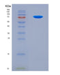 SDS-PAGE analysis of Human CTNNB1 (Catenin Beta-1) - Recombinant Protein, CAT# BLT-08794P showing >90% purity under 15% SDS-PAGE (Reduced)