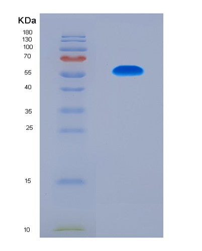SDS-PAGE analysis of Human ADAMTS13 (A Disintegrin And Metalloproteinase With Thrombospondin Motifs 13) - Recombinant Protein, CAT# BLT-08797P showing >90% purity under 15% SDS-PAGE (Reduced)
