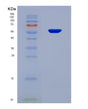 SDS-PAGE analysis of Human NADK (Nad Kinase) - Recombinant Protein, CAT# BLT-08801P showing >90% purity under 15% SDS-PAGE (Reduced)