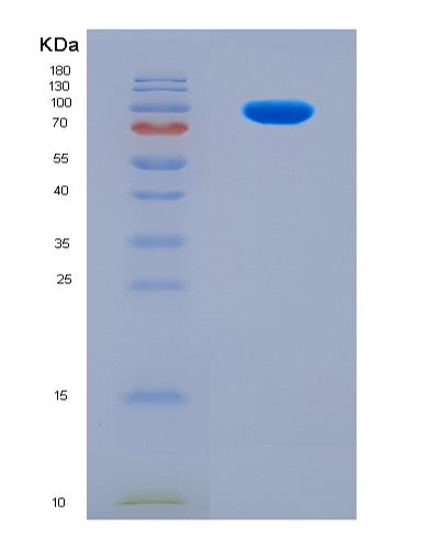 SDS-PAGE analysis of Human COP1 (E3 Ubiquitin-Protein Ligase Cop1) - Recombinant Protein, CAT# BLT-08802P showing >90% purity under 15% SDS-PAGE (Reduced)