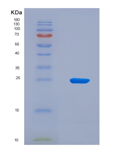 SDS-PAGE analysis of Human LTB (Lymphotoxin-Beta) - Recombinant Protein, CAT# BLT-08803P showing >90% purity under 15% SDS-PAGE (Reduced)
