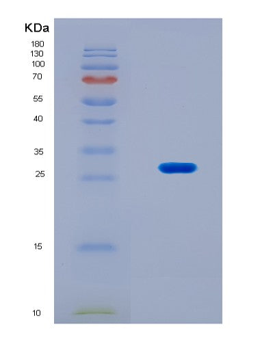 SDS-PAGE analysis of Human MBD1 (Methyl-Cpg-Binding Domain Protein 1) - Recombinant Protein, CAT# BLT-08804P showing >90% purity under 15% SDS-PAGE (Reduced)