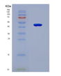 SDS-PAGE analysis of Human CD99 (Cd99 Antigen) - Recombinant Protein, CAT# BLT-08807P showing >90% purity under 15% SDS-PAGE (Reduced)