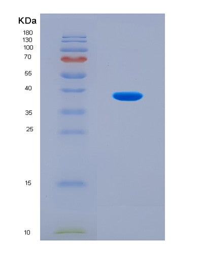 SDS-PAGE analysis of Human CTSL (Procathepsin L) - Recombinant Protein, CAT# BLT-08811P showing >90% purity under 15% SDS-PAGE (Reduced)