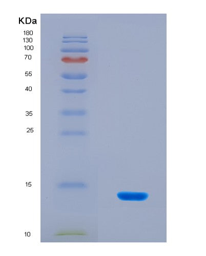 SDS-PAGE analysis of Human ANO6 (Anoctamin-6) - Recombinant Protein, CAT# BLT-08814P showing >90% purity under 15% SDS-PAGE (Reduced)