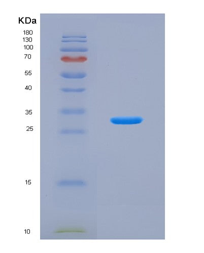 SDS-PAGE analysis of Human DNMT3B (Dna (Cytosine-5)-Methyltransferase 3B) - Recombinant Protein, CAT# BLT-08815P showing >90% purity under 15% SDS-PAGE (Reduced)