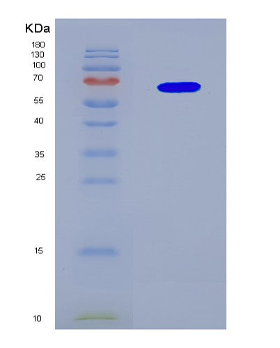 SDS-PAGE analysis of Human TTBK1 (Tau-Tubulin Kinase 1) - Recombinant Protein, CAT# BLT-08817P showing >90% purity under 15% SDS-PAGE (Reduced)