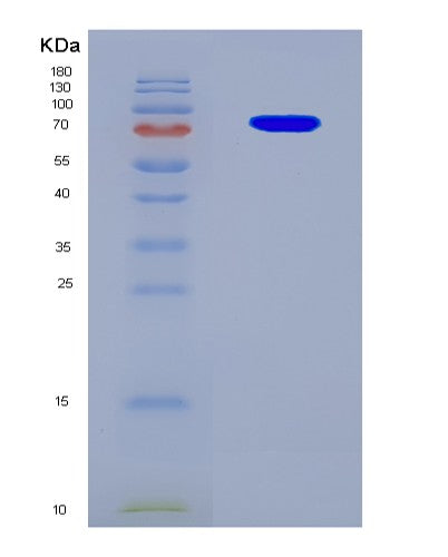 SDS-PAGE analysis of Human GBP5 (Guanylate-Binding Protein 5) - Recombinant Protein, CAT# BLT-08818P showing >90% purity under 15% SDS-PAGE (Reduced)