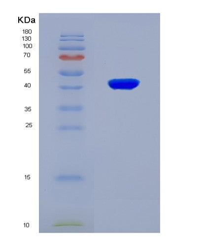 SDS-PAGE analysis of Mouse Sdhc (Succinate Dehydrogenase Cytochrome B560 Subunit, Mitochondrial) - Recombinant Protein, CAT# BLT-08819P showing >90% purity under 15% SDS-PAGE (Reduced)
