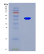 SDS-PAGE analysis of Mouse Sdhc (Succinate Dehydrogenase Cytochrome B560 Subunit, Mitochondrial) - Recombinant Protein, CAT# BLT-08819P showing >90% purity under 15% SDS-PAGE (Reduced)