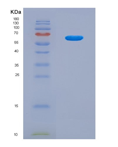 SDS-PAGE analysis of Human STAT3 (Signal Transducer And Activator Of Transcription 3) - Recombinant Protein, CAT# BLT-08820P showing >95% purity under 15% SDS-PAGE (Reduced)