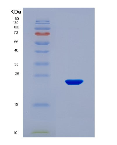 SDS-PAGE analysis of Human SUGP2 (Surp And G-Patch Domain-Containing Protein 2) - Recombinant Protein, CAT# BLT-08821P showing >95% purity under 15% SDS-PAGE (Reduced)