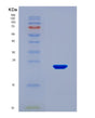 SDS-PAGE analysis of Human SUGP2 (Surp And G-Patch Domain-Containing Protein 2) - Recombinant Protein, CAT# BLT-08821P showing >95% purity under 15% SDS-PAGE (Reduced)