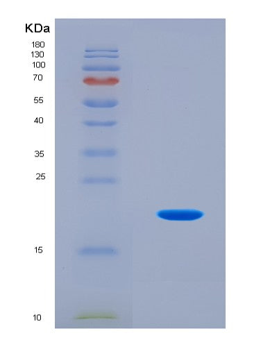 SDS-PAGE analysis of Mouse Sugp2 (Surp And G-Patch Domain-Containing Protein 2) - Recombinant Protein, CAT# BLT-08822P showing >95% purity under 15% SDS-PAGE (Reduced)