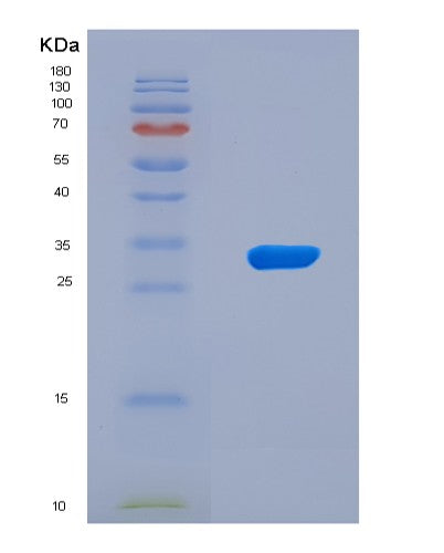 SDS-PAGE analysis of Human MTAP (S-Methyl-5'-Thioadenosine Phosphorylase) - Recombinant Protein, CAT# BLT-08823P showing >95% purity under 15% SDS-PAGE (Reduced)