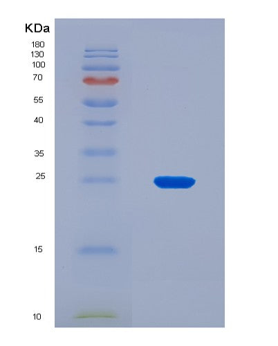 SDS-PAGE analysis of Human EVPL (Envoplakin) - Recombinant Protein, CAT# BLT-08824P showing >95% purity under 15% SDS-PAGE (Reduced)
