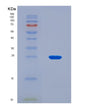 SDS-PAGE analysis of Human EVPL (Envoplakin) - Recombinant Protein, CAT# BLT-08824P showing >95% purity under 15% SDS-PAGE (Reduced)