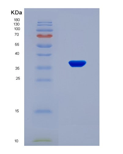 SDS-PAGE analysis of Human DUSP6 (Dual Specificity Protein Phosphatase 6) - Recombinant Protein, CAT# BLT-08825P showing >90% purity under 15% SDS-PAGE (Reduced)