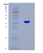 SDS-PAGE analysis of Human DUSP6 (Dual Specificity Protein Phosphatase 6) - Recombinant Protein, CAT# BLT-08825P showing >90% purity under 15% SDS-PAGE (Reduced)