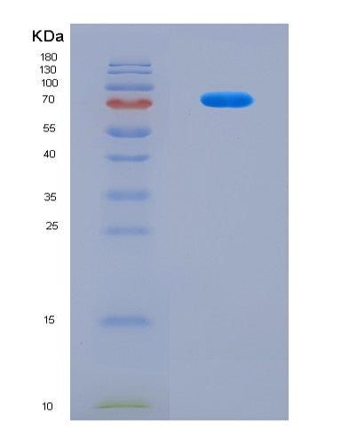 SDS-PAGE analysis of Human LSS (Lanosterol Synthase) - Recombinant Protein, CAT# BLT-08826P showing >90% purity under 15% SDS-PAGE (Reduced)