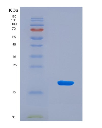 SDS-PAGE analysis of Mouse Npm1 (Nucleophosmin) - Recombinant Protein, CAT# BLT-08828P showing >90% purity under 15% SDS-PAGE (Reduced)