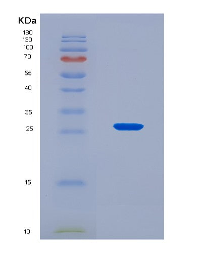 SDS-PAGE analysis of Human TIMP3 (Metalloproteinase Inhibitor 3) - Recombinant Protein, CAT# BLT-08829P showing >90% purity under 15% SDS-PAGE (Reduced)