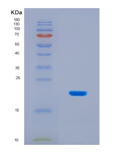 SDS-PAGE analysis of Human MTOR (Serine/Threonine-Protein Kinase Mtor) - Recombinant Protein, CAT# BLT-08830P showing >90% purity under 15% SDS-PAGE (Reduced)