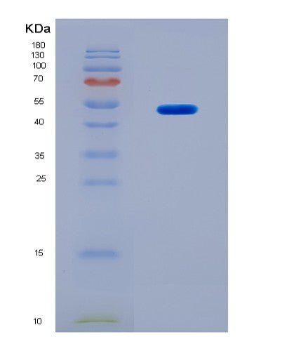 SDS-PAGE analysis of Human CSK (Tyrosine-Protein Kinase Csk) - Recombinant Protein, CAT# BLT-08832P showing >90% purity under 15% SDS-PAGE (Reduced)