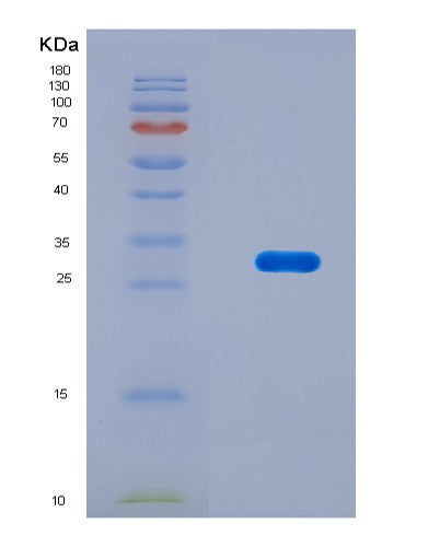 SDS-PAGE analysis of Mouse Ripk3 (Receptor-Interacting Serine/Threonine-Protein Kinase 3) - Recombinant Protein, CAT# BLT-08834P showing >90% purity under 15% SDS-PAGE (Reduced)
