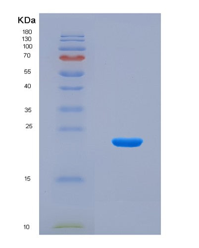 SDS-PAGE analysis of Human RAB1B (Ras-Related Protein Rab-1B) - Recombinant Protein, CAT# BLT-08835P showing >90% purity under 15% SDS-PAGE (Reduced)