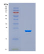 SDS-PAGE analysis of Human RAB1B (Ras-Related Protein Rab-1B) - Recombinant Protein, CAT# BLT-08835P showing >90% purity under 15% SDS-PAGE (Reduced)