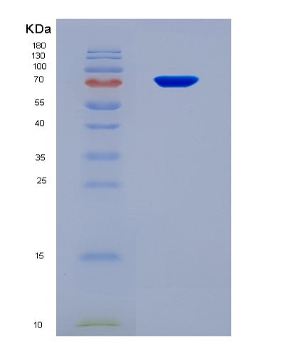 SDS-PAGE analysis of Human ATP2A2 (Sarcoplasmic/Endoplasmic Reticulum Calcium Atpase 2) - Recombinant Protein, CAT# BLT-08836P showing >90% purity under 15% SDS-PAGE (Reduced)