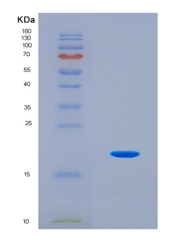 SDS-PAGE analysis of Human NOS3 (Nitric Oxide Synthase 3) - Recombinant Protein, CAT# BLT-08837P showing >90% purity under 15% SDS-PAGE (Reduced)