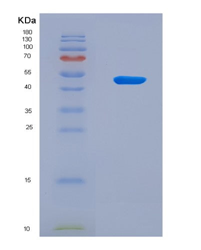 SDS-PAGE analysis of Human OLIG2 (Oligodendrocyte Transcription Factor 2) - Recombinant Protein, CAT# BLT-08839P showing >90% purity under 15% SDS-PAGE (Reduced)